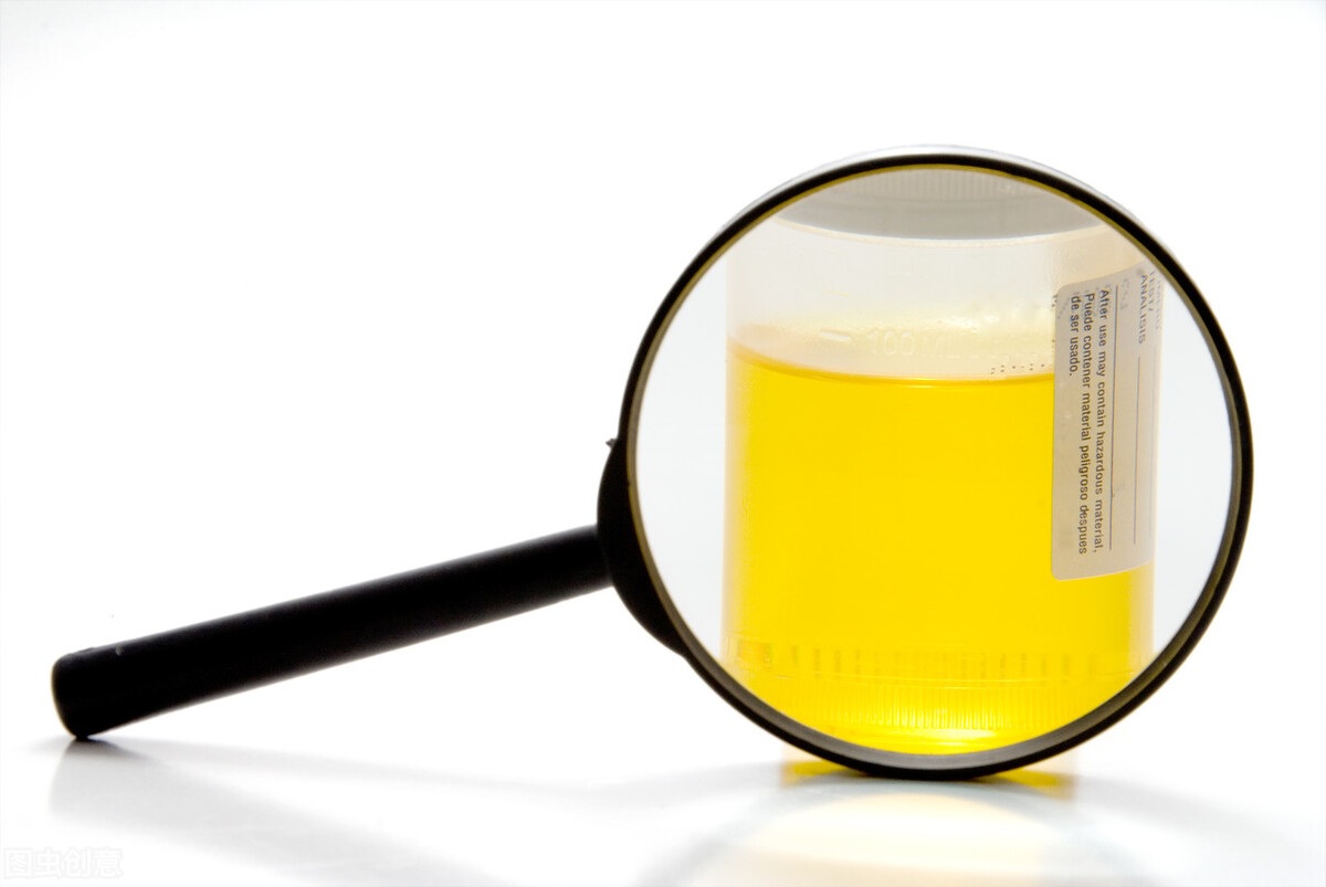 尿液发黄是什么原因 尿特别黄是什么原因