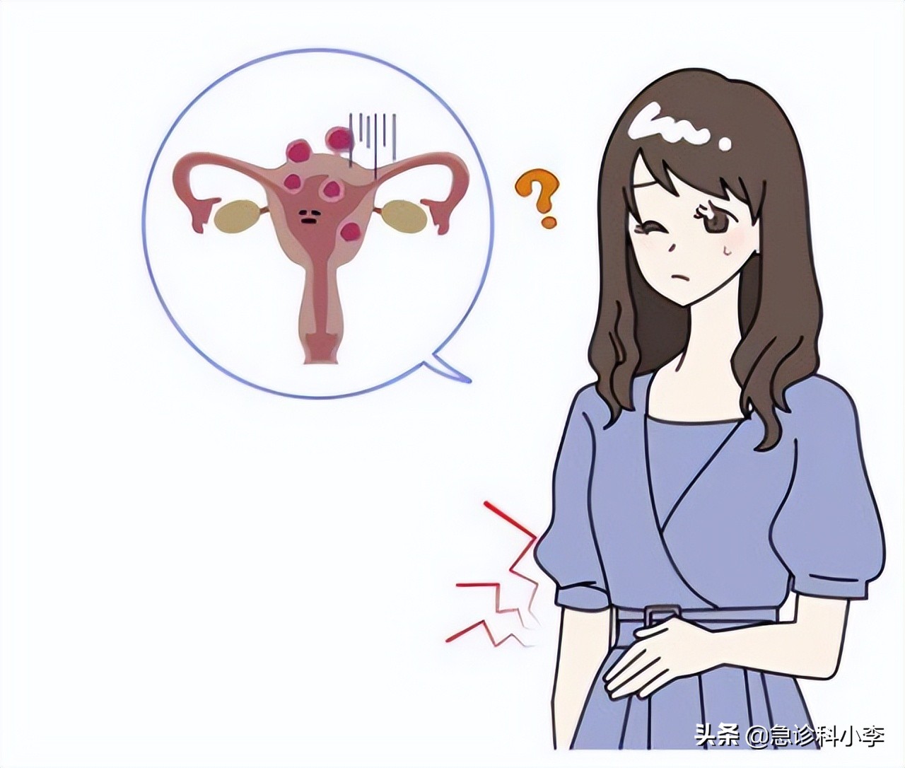 子宫肌瘤是什么原因导致的 子宫肌瘤是怎么长出来的