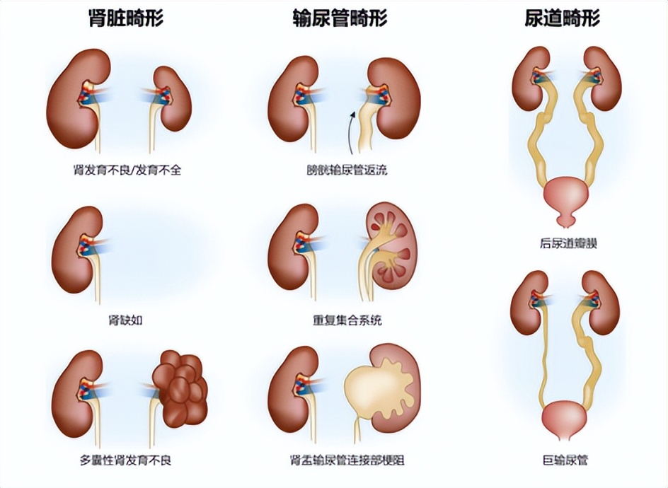 人体内脏结构图 人体内脏解剖图