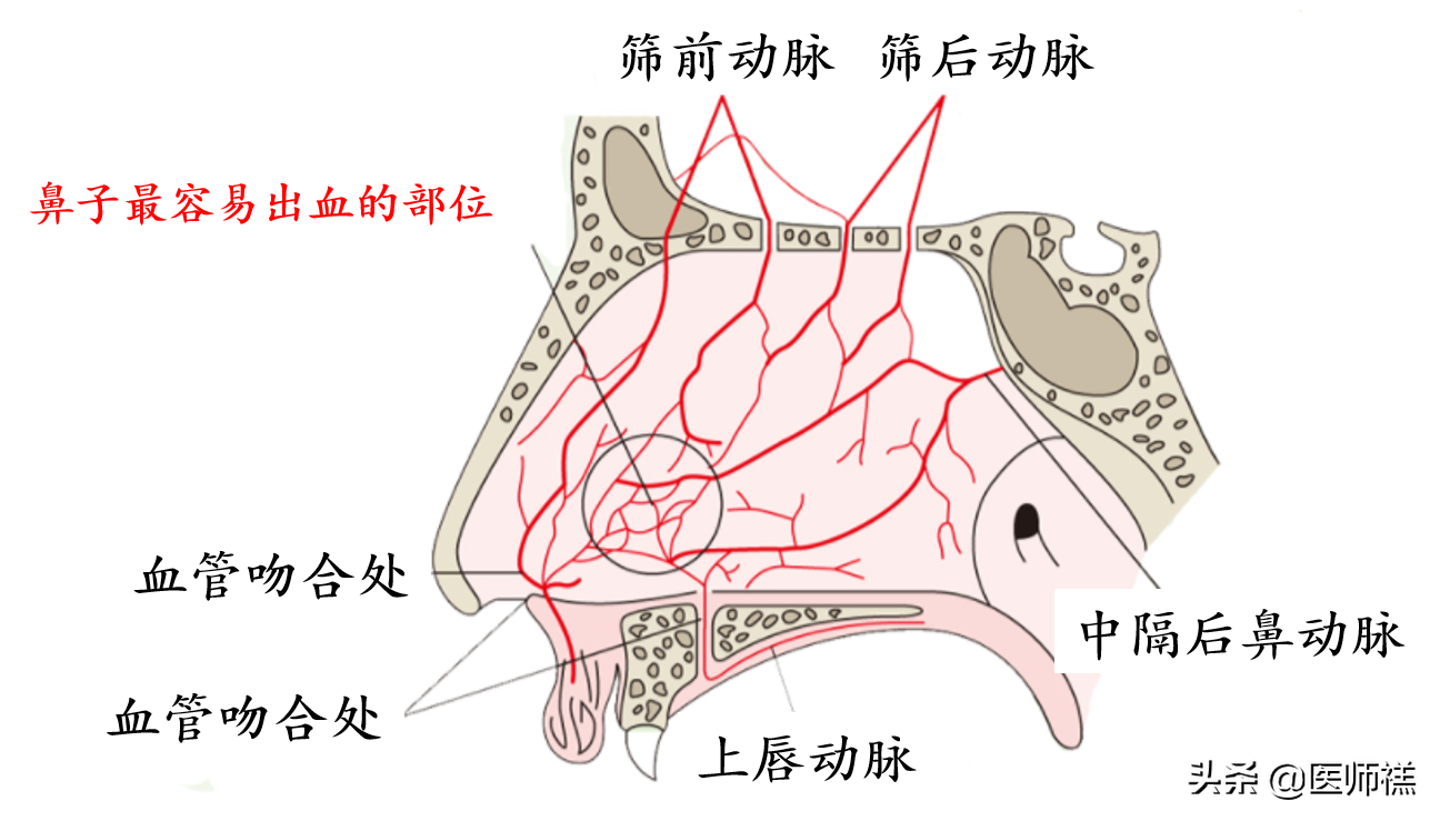 流鼻血是什么原因引起的呢? 单侧流鼻血是怎么回事