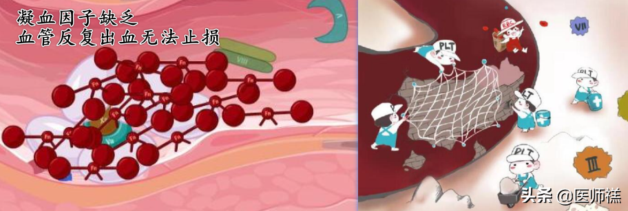 流鼻血是什么原因引起的呢? 单侧流鼻血是怎么回事