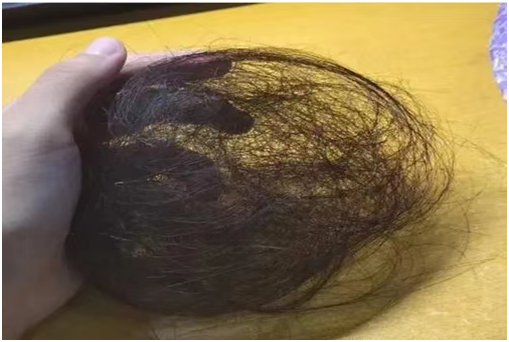头发稀疏怎么恢复 头发稀疏会自己恢复吗