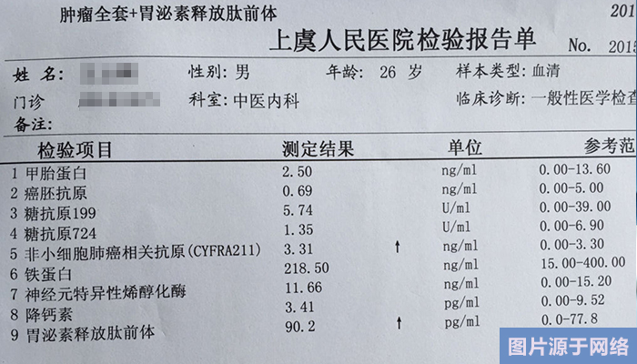 淋巴细胞比率偏高是什么意思 淋巴细胞数偏高是怎么回事