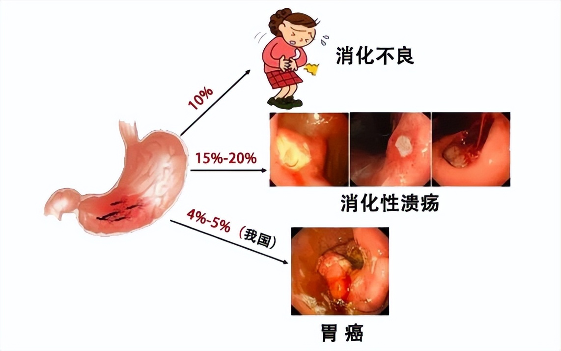 为什么不建议年轻人做碳14 碳14多少钱做一次