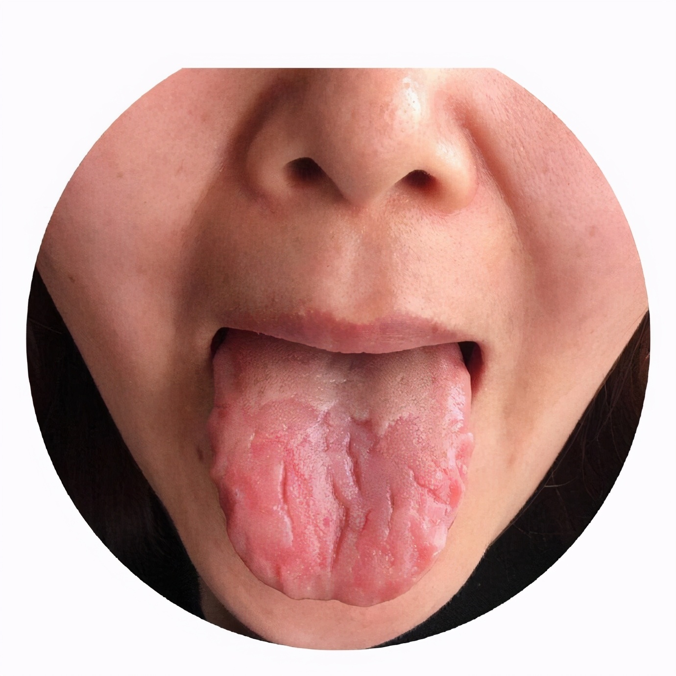 舌头发麻是什么原因 舌头发麻吃什么药最有效