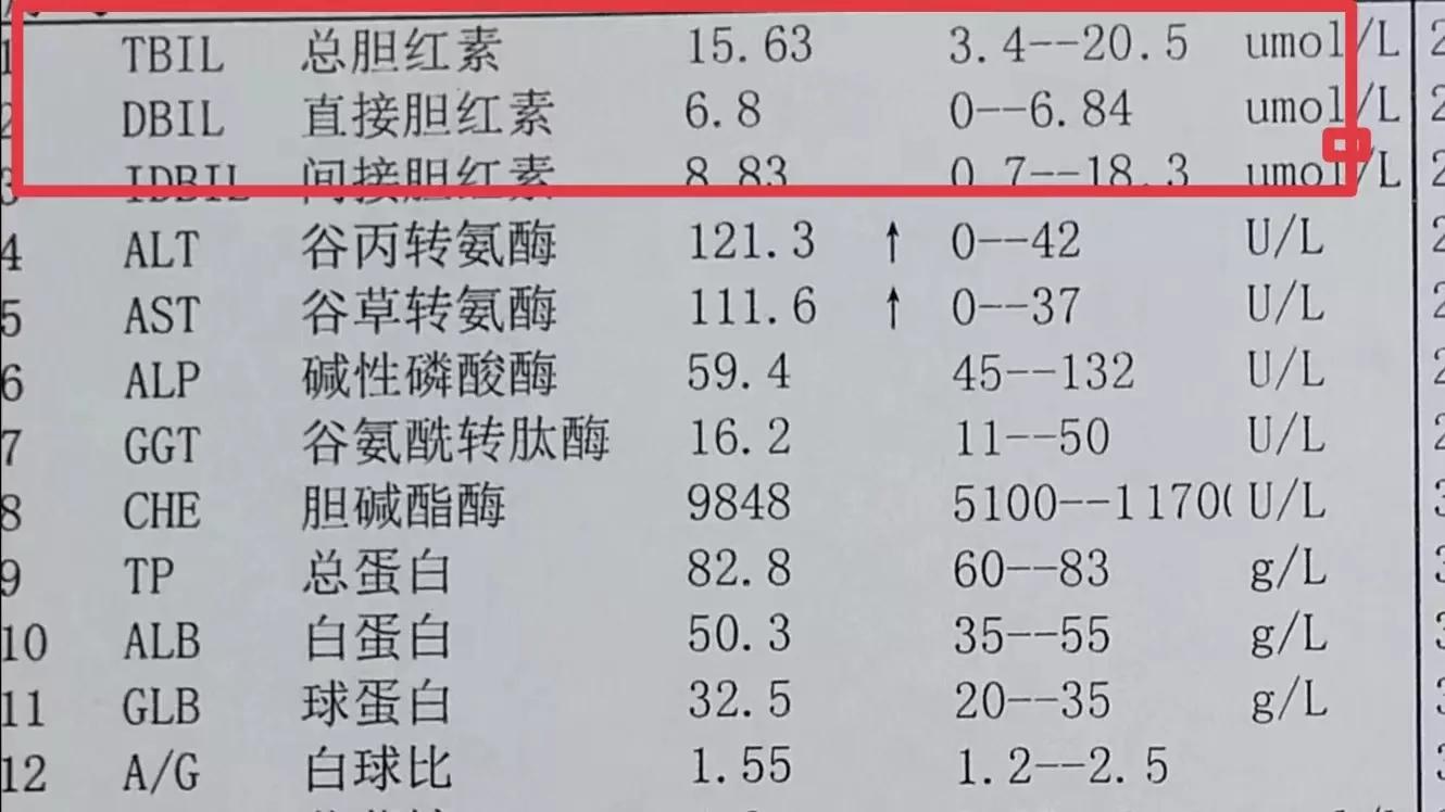 肝功能检查多少钱 肝功13项大概多少钱