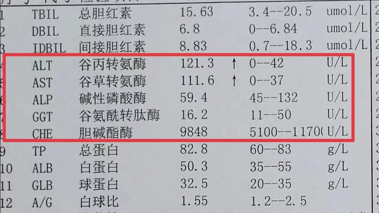 肝功能检查多少钱 肝功13项大概多少钱