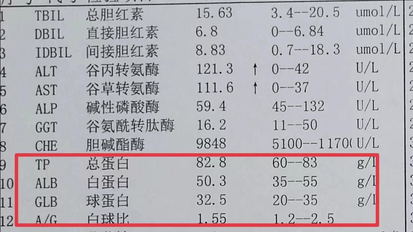 肝功能检查多少钱 肝功13项大概多少钱