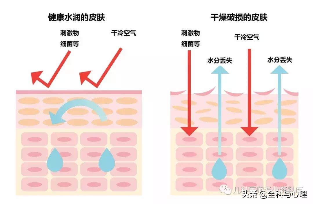 婴儿湿疹图片 小米粒丘疹图片