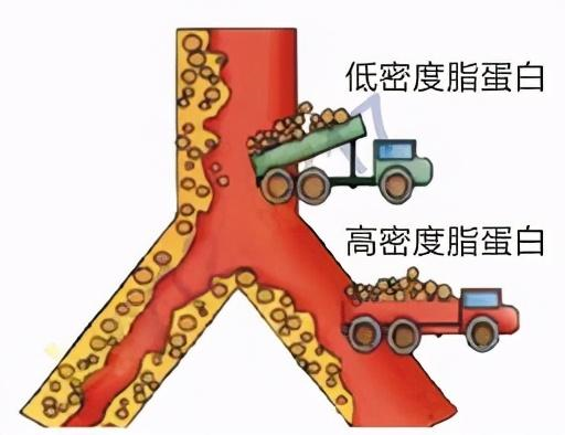 高密度脂蛋白偏高 血小板压积偏高