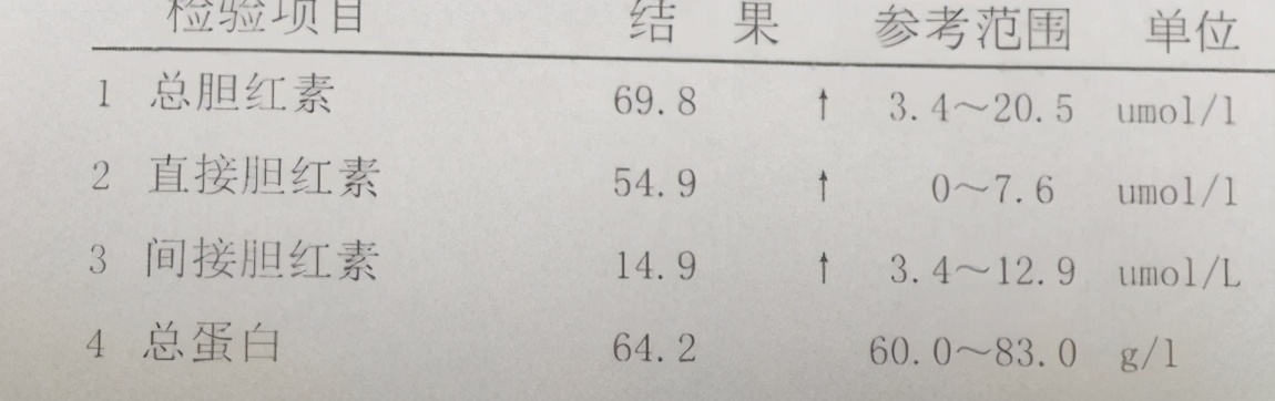 总胆红素高是什么原因 总胆红素高怎么治疗