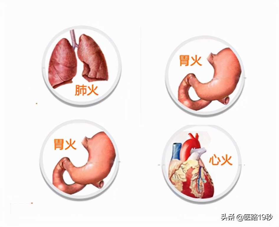 心火旺吃什么药 心火大吃什么药好得快