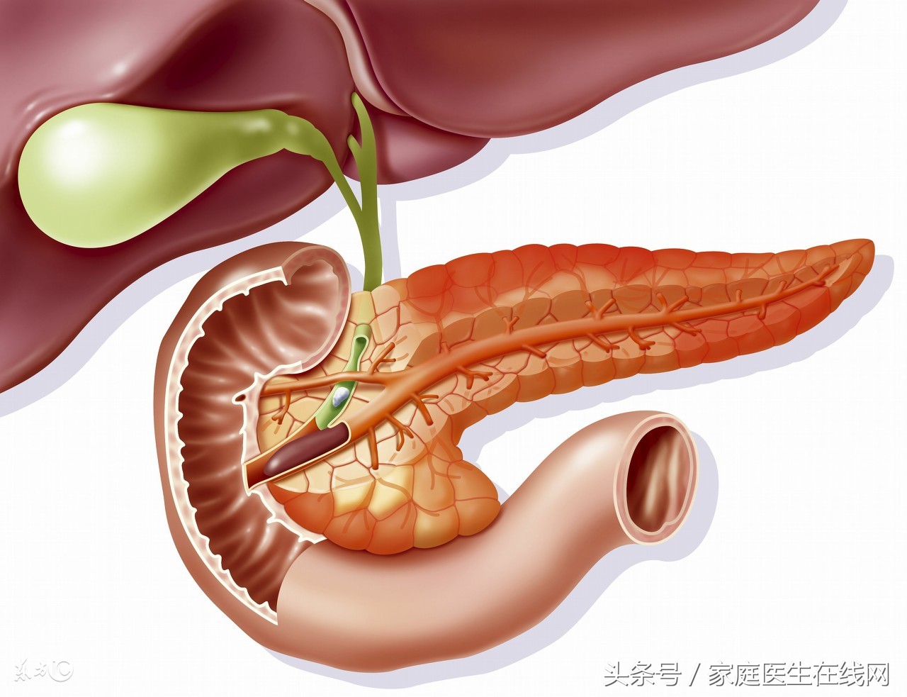 胰腺炎能治好吗 胰腺炎怎么引起的