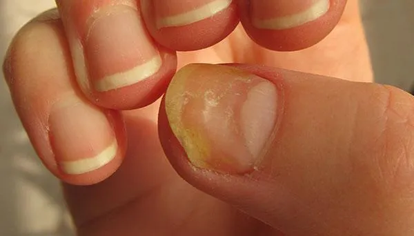 指甲上的月牙代表什么 手指甲上的月牙图解