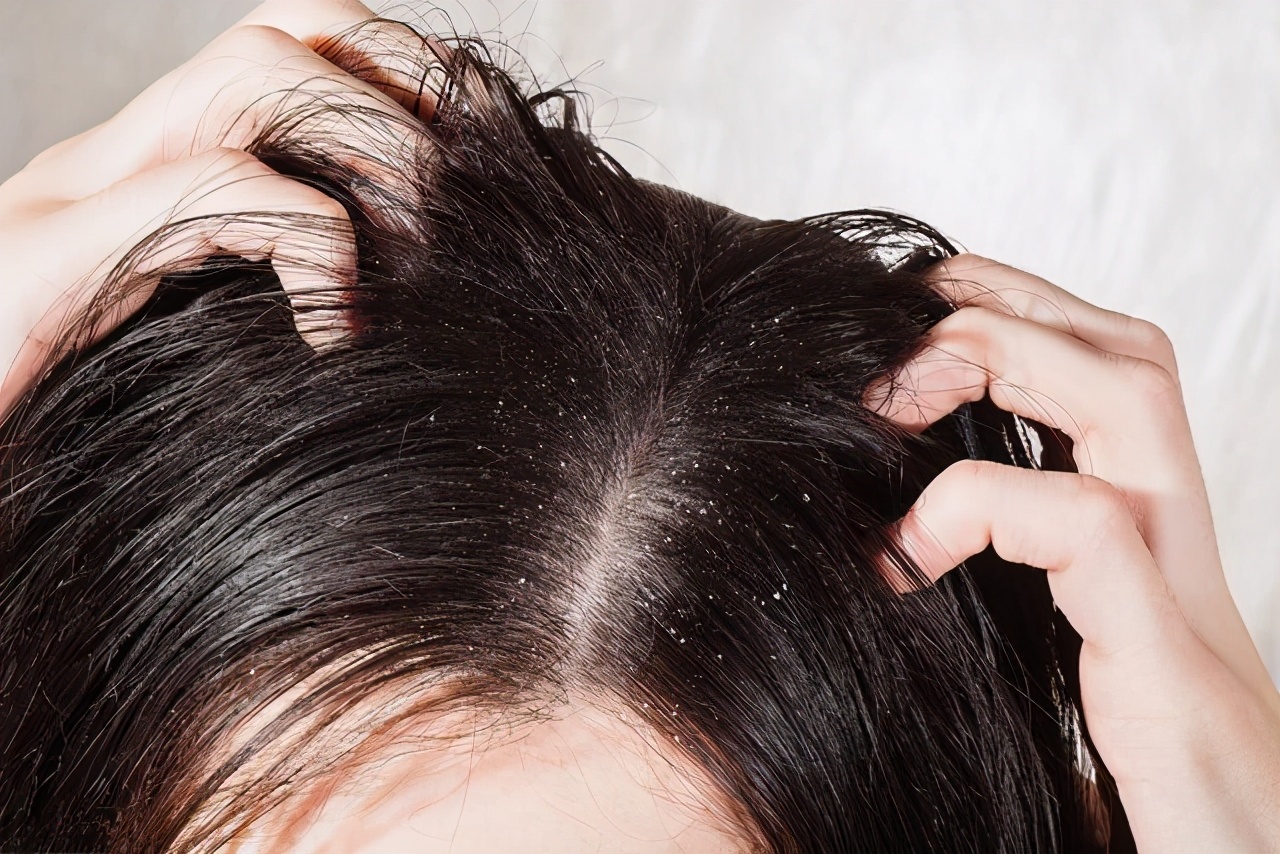 治疗白发最好的方法 治疗白发最有效的药